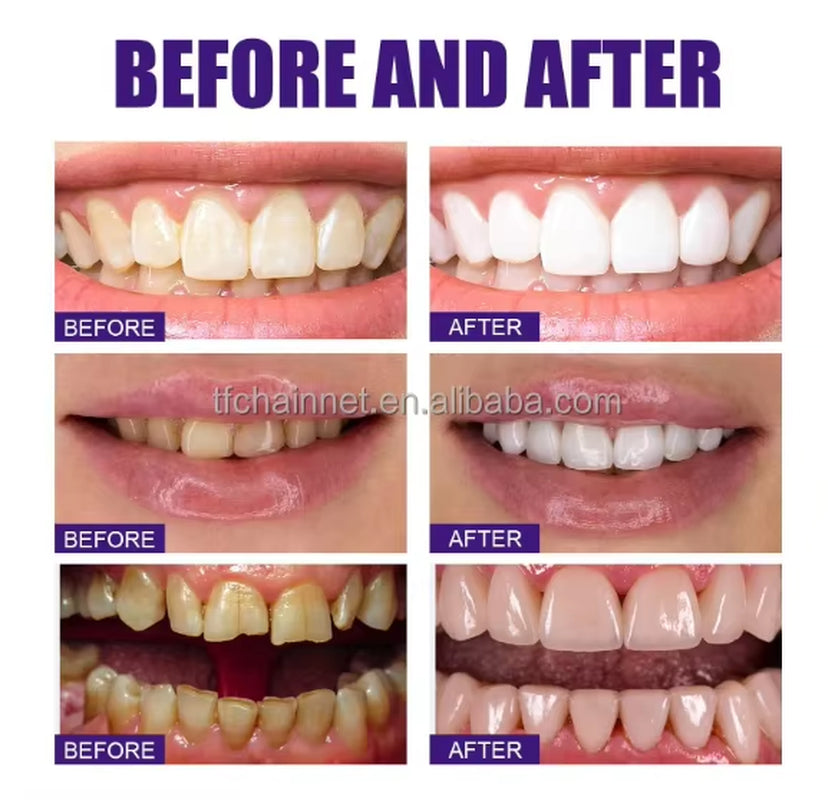 Wholesale Oral Care Custom 30Ml Natural Fluoride Free Colour Corrector Purple Whitening Teeth Whitening Mousse Toothpaste